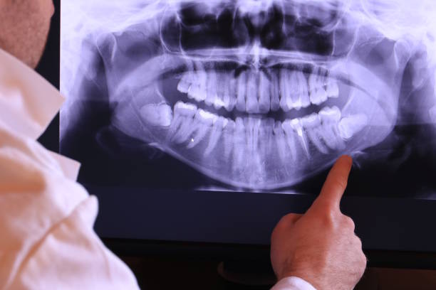 Best Broken or Cracked Tooth Emergency Dentist in Lake Pocotopaug, CT
